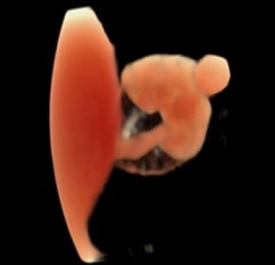 Excelență internațională în imagistica fetală - recunoaștere pentru Spitalul Pelican Oradea